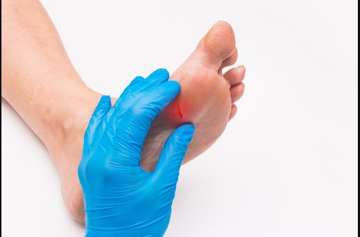 diabetic foot