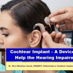 Cochlear Implant-A Device to Help the Hearing Impaired